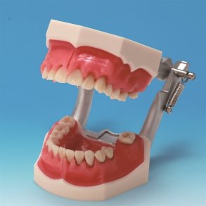 Parodontitis Studiemodel med Aftageligt Gingiva 